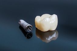 Patientin beim Zahnarzt bekommt den Weißton ihrer Zähne verglichen
